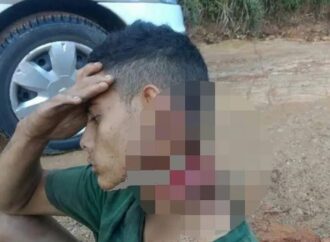 thanh niên 18t bị cướp sathại vẫn đi bộ 500m để cầu cứu