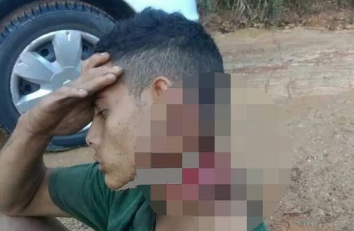 thanh niên 18t bị cướp sathại vẫn đi bộ 500m để cầu cứu