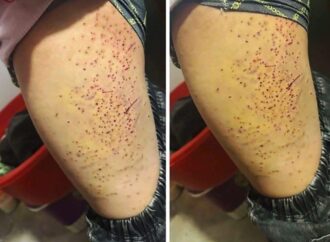 Mâu thuẫn chỗ ngồi trong lớp, nữ sinh lớp 7 dùng bút bi đ** nhiều lần vào bạn học