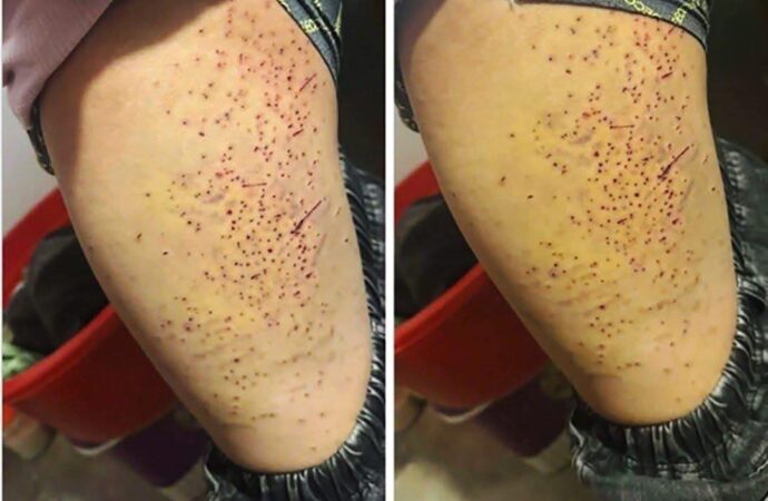 Mâu thuẫn chỗ ngồi trong lớp, nữ sinh lớp 7 dùng bút bi đ** nhiều lần vào bạn học